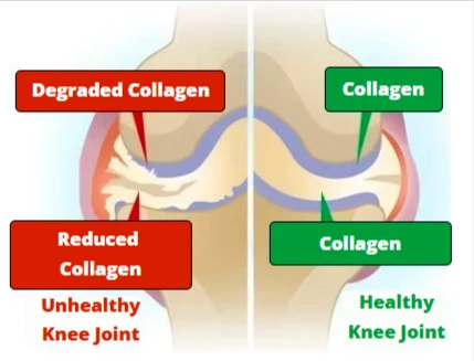 Benefits of NativePath Joint Health